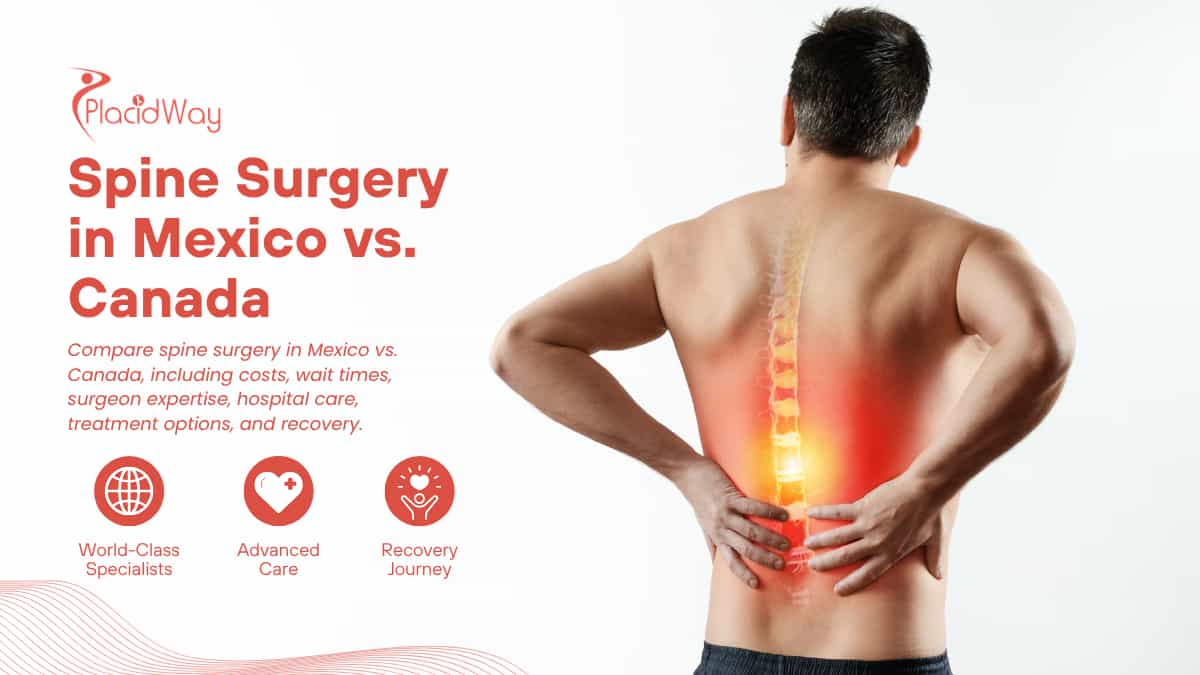 Spine Surgery in Mexico vs Canada