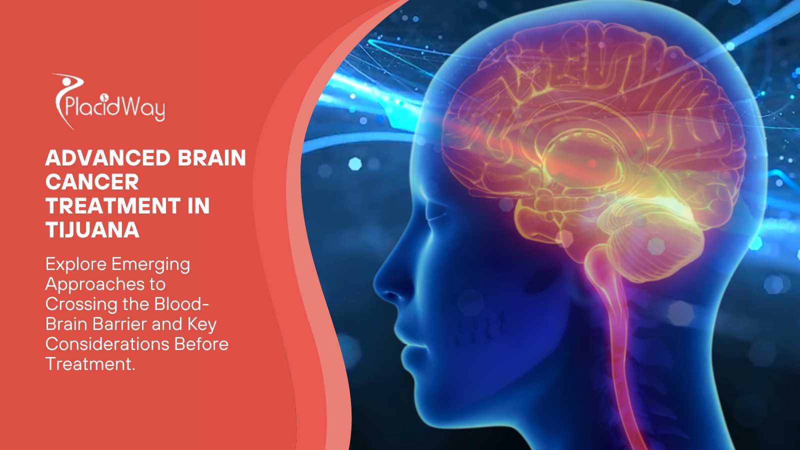 Advanced Brain Cancer Treatment in Tijuana - Crossing the Blood-Brain Barrier