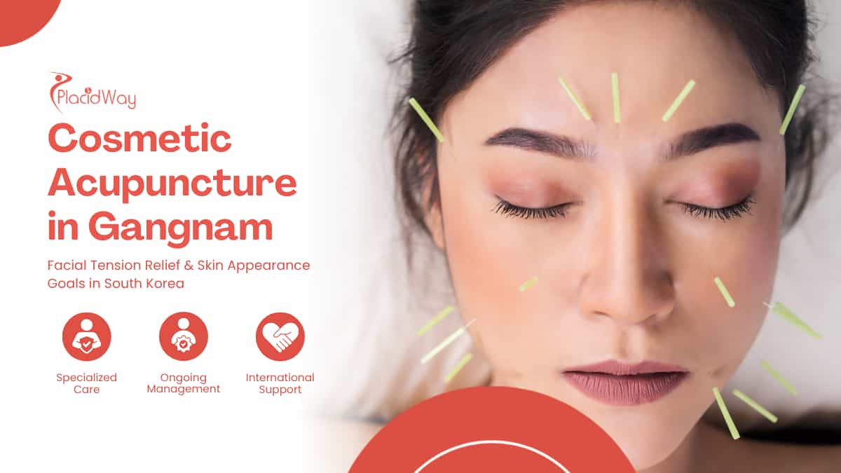 Cosmetic Acupuncture in Gangnam