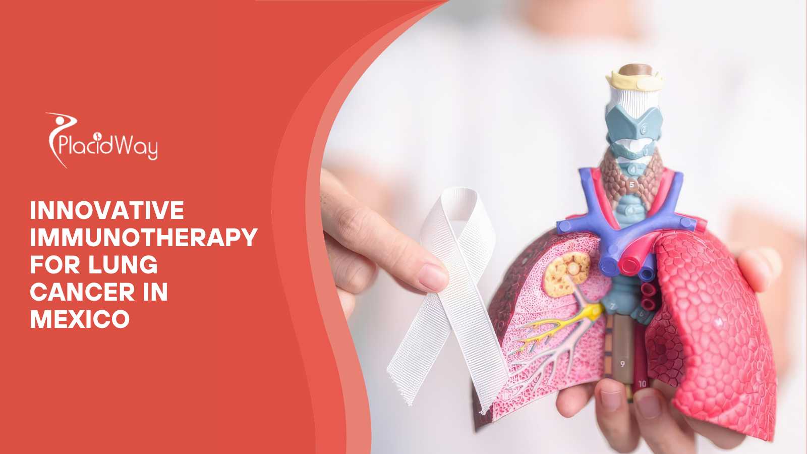 Innovative Immunotherapy Approaches for Lung Cancer: Trends from Mexican Cancer Centers