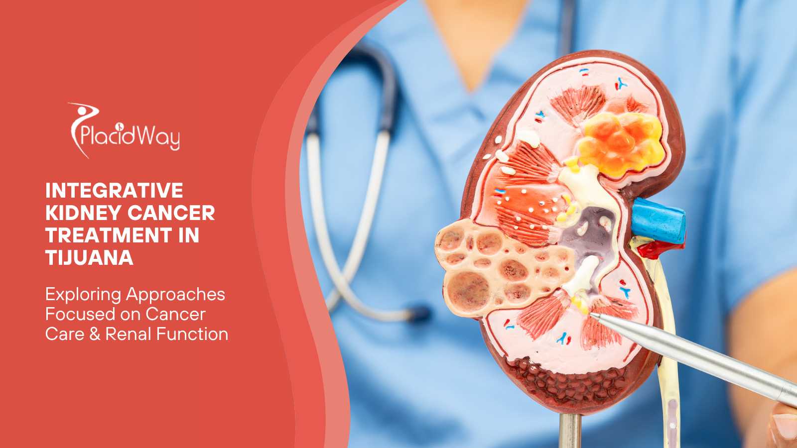 Integrative Kidney Cancer Treatment in Tijuana - Preserving Renal Function