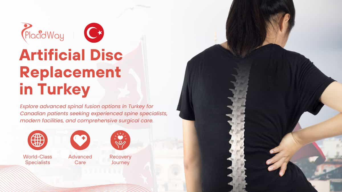Artificial Disc Replacement in Turkey