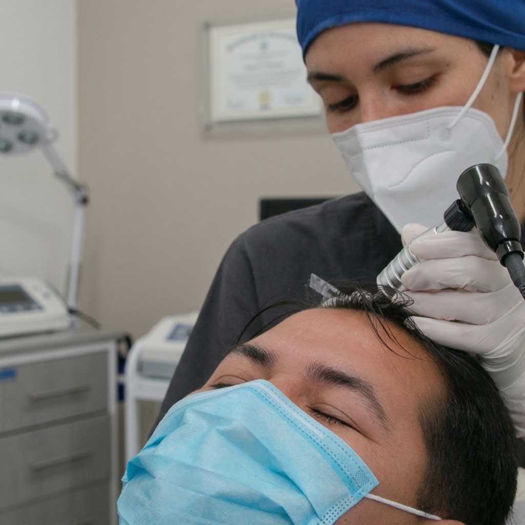 Hair Transplant in Guadalajara Mexico by Hair in 1 Day