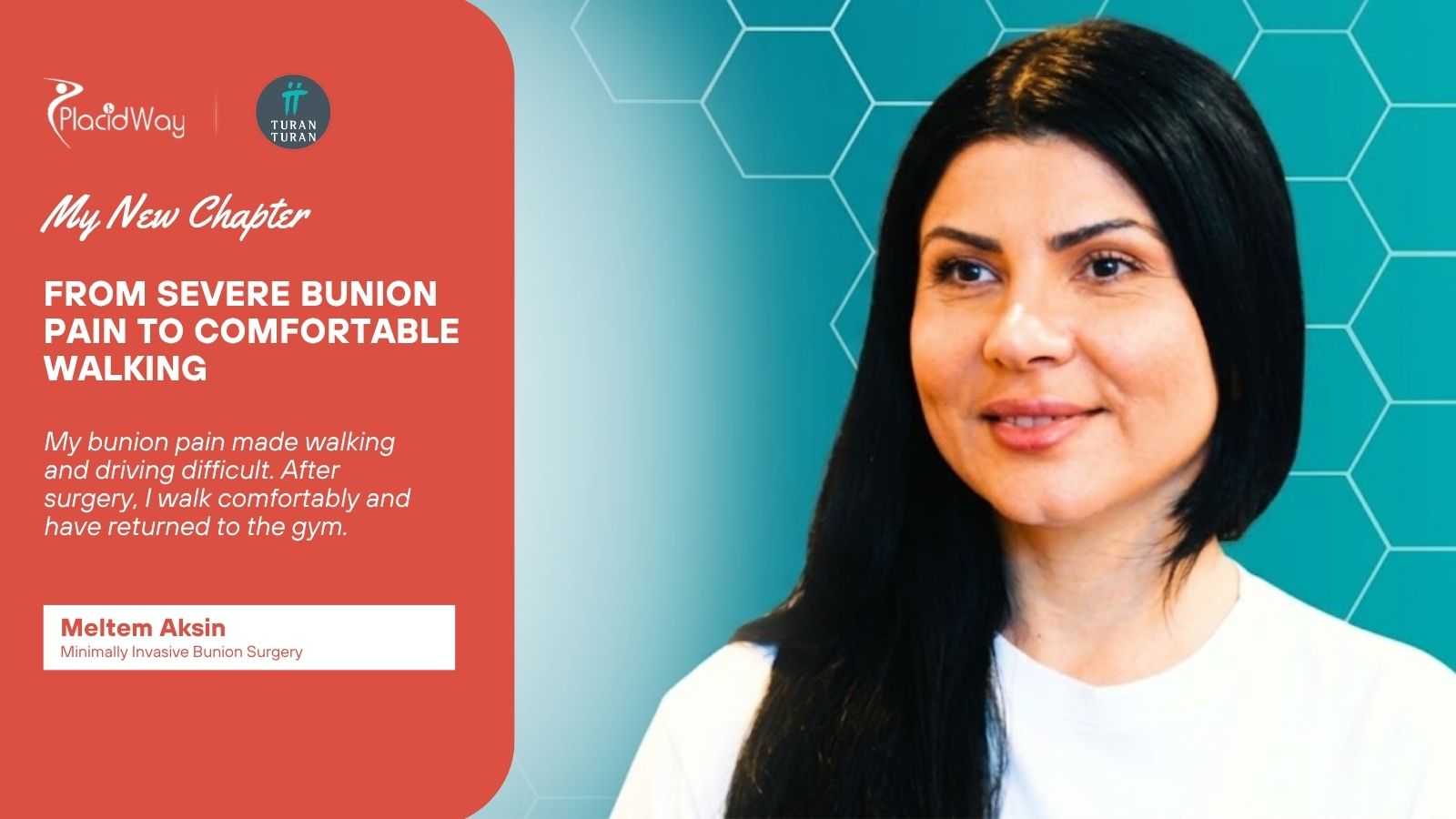 Minimally Invasive Bunion Surgery in Istanbul Turkey