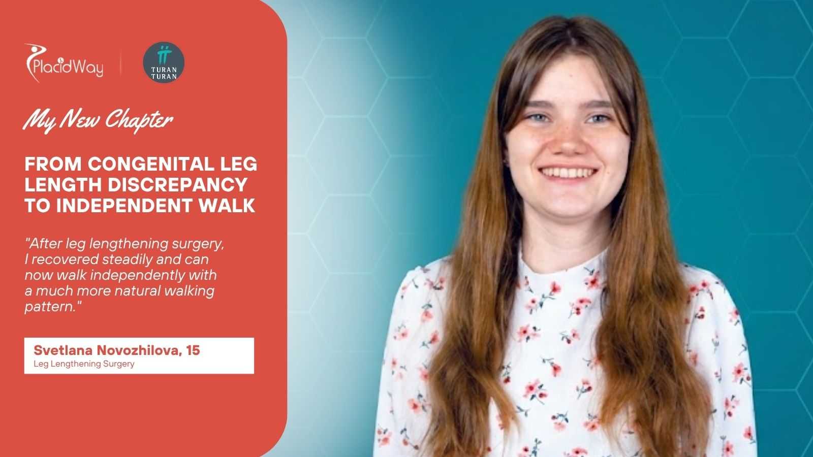 Svetlana Novozhilova Leg Lengthening Surgery in Istanbul Turkey