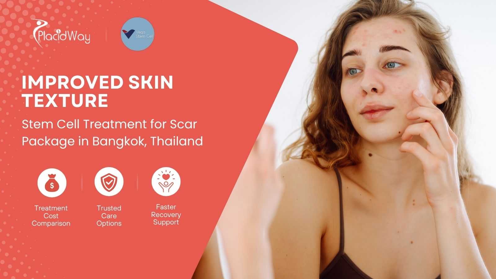 Stem Cell Treatment for Scar in Bangkok Thailand at Vega Clinic
