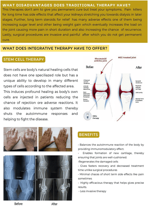 Regenerative therapy process for rheumatoid arthritis in India