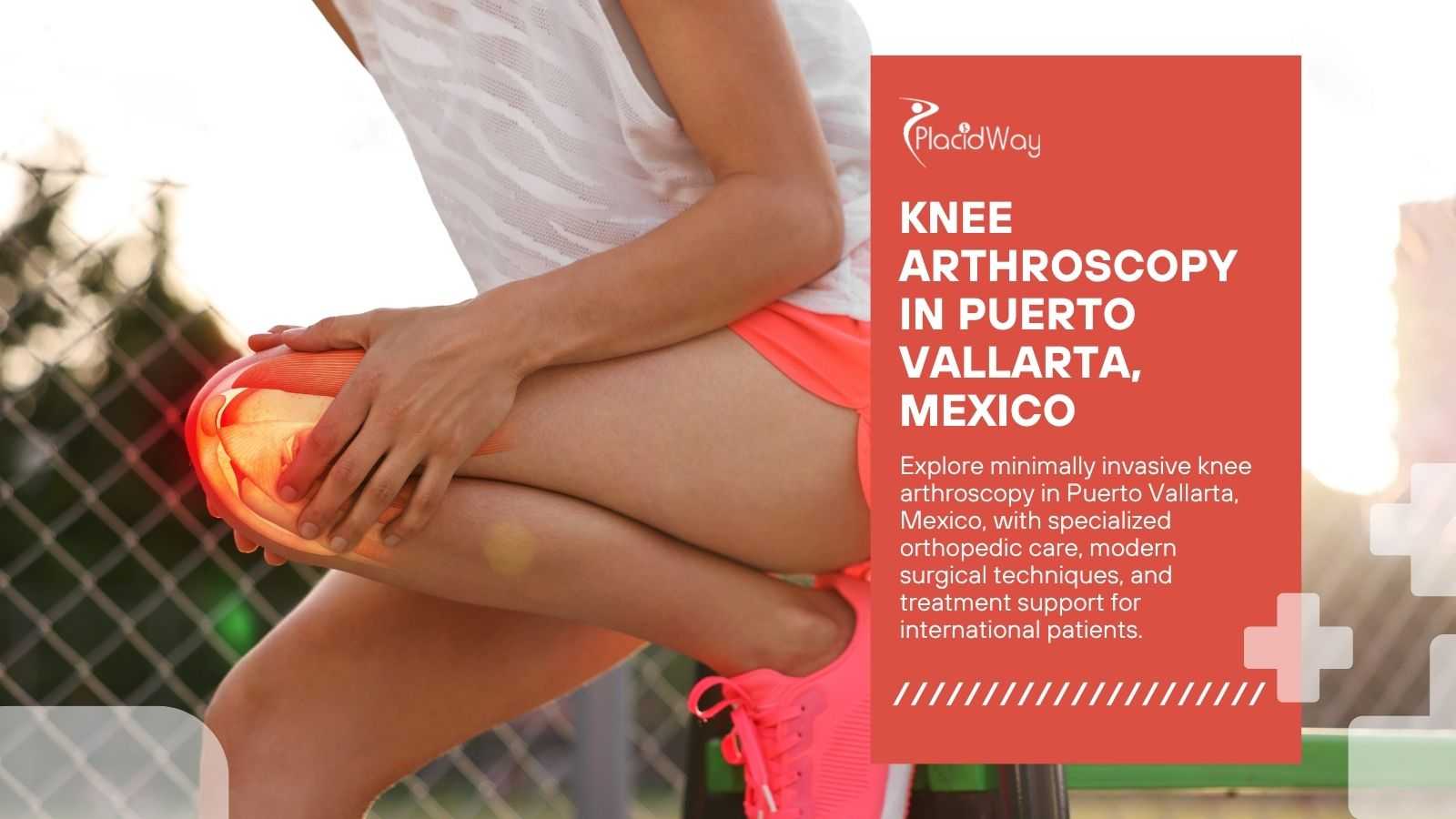 Knee Arthroscopy in Puerto Vallarta