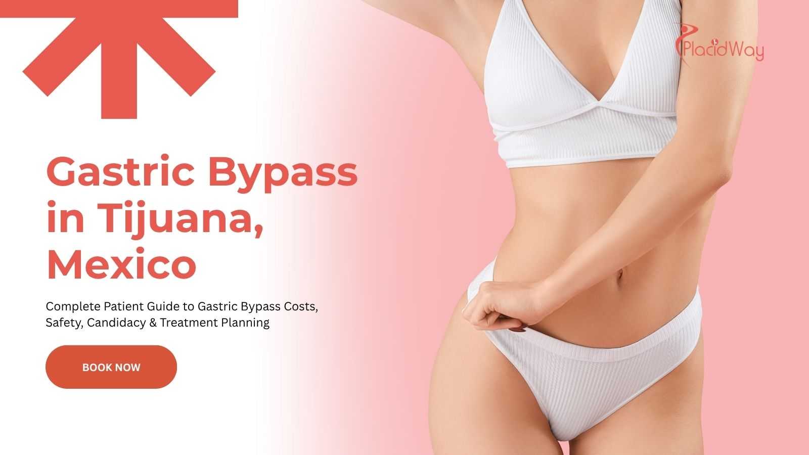 Gastric Bypass in Tijuana