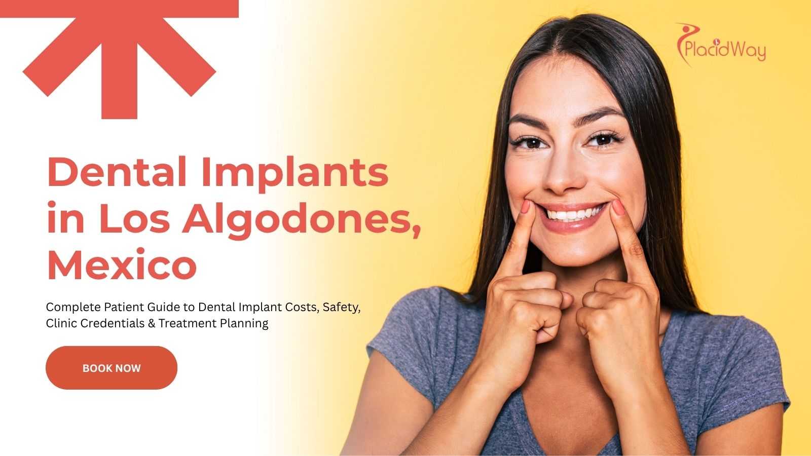 Dental Implants in Los Algodones