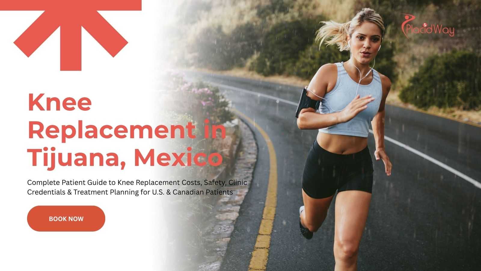Knee Replacement in Tijuana