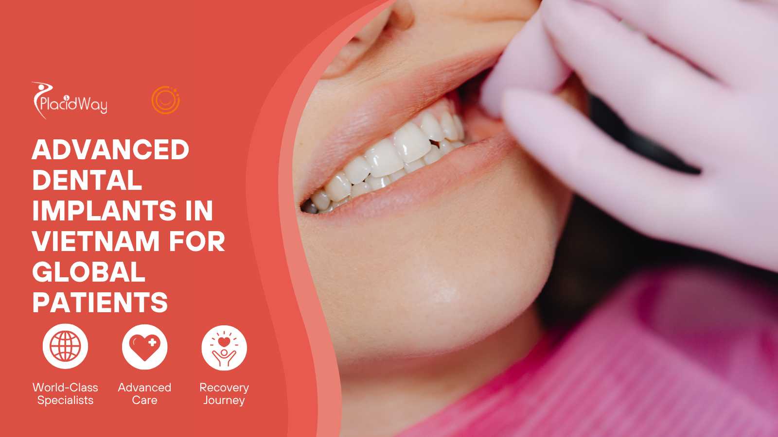 Orion Dental Implant Vietnam