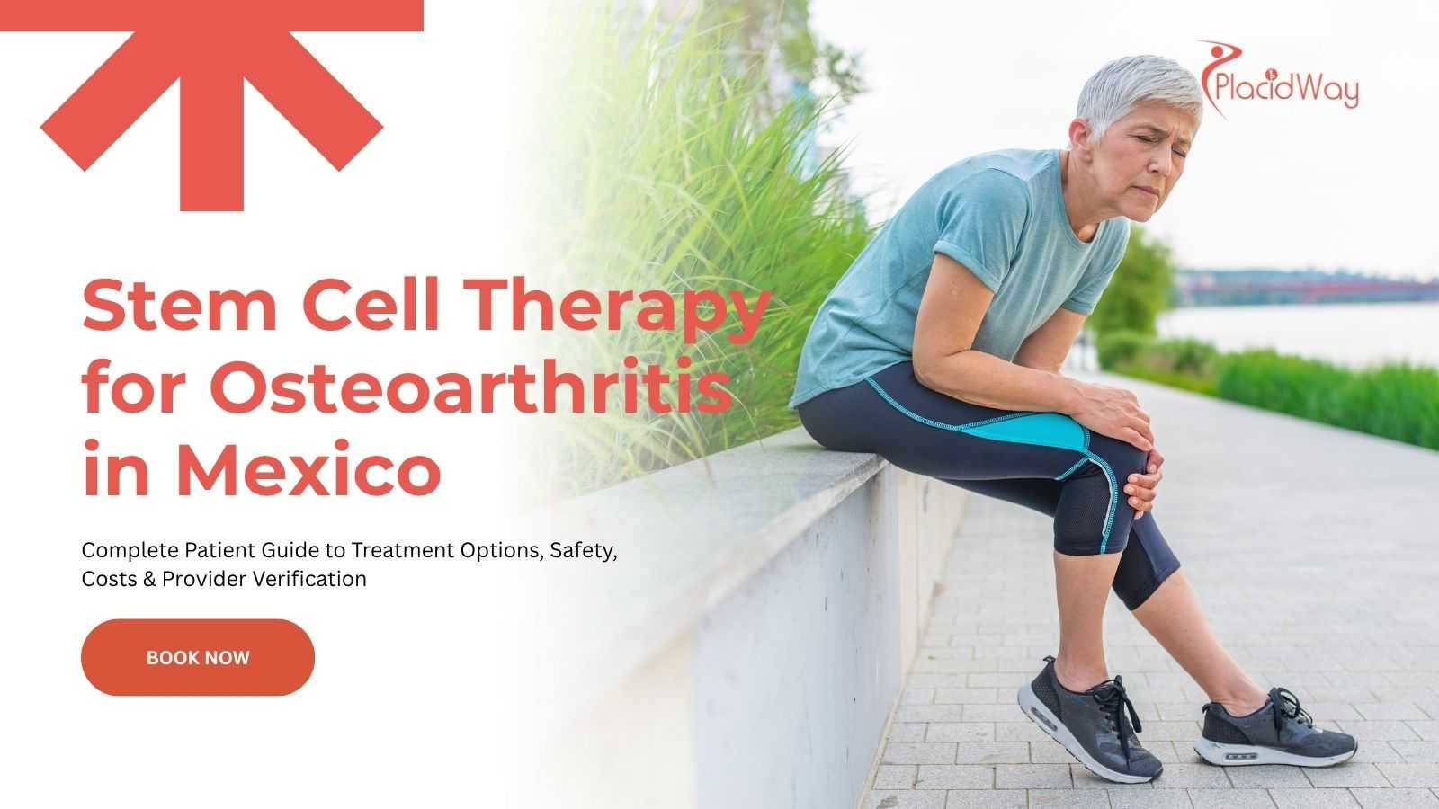 Stem cell therapy for osteoarthritis in Mexico