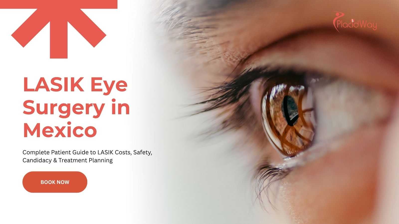 LASIK eye surgery in Mexico