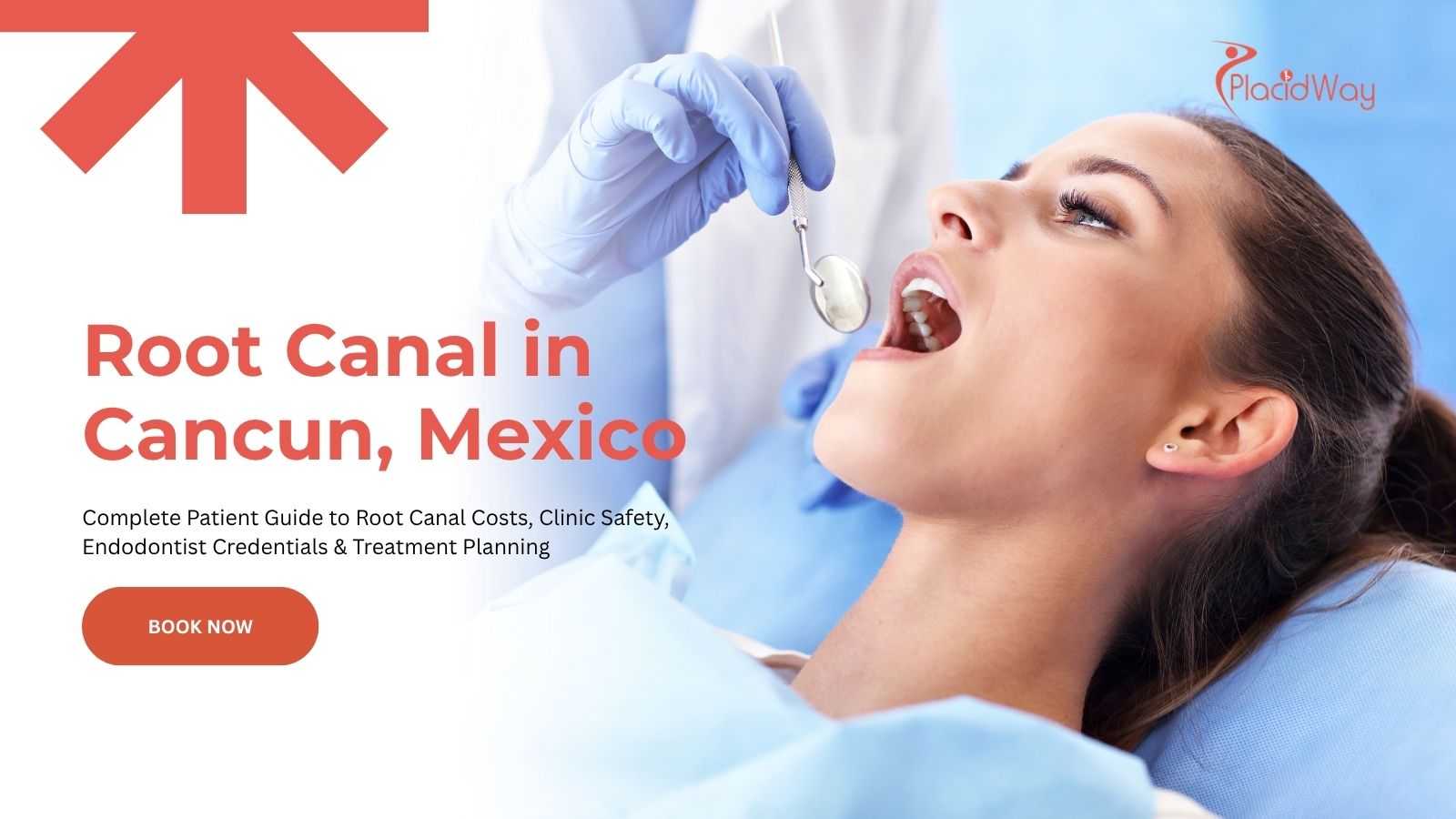 Root canal treatment in Cancun, Mexico