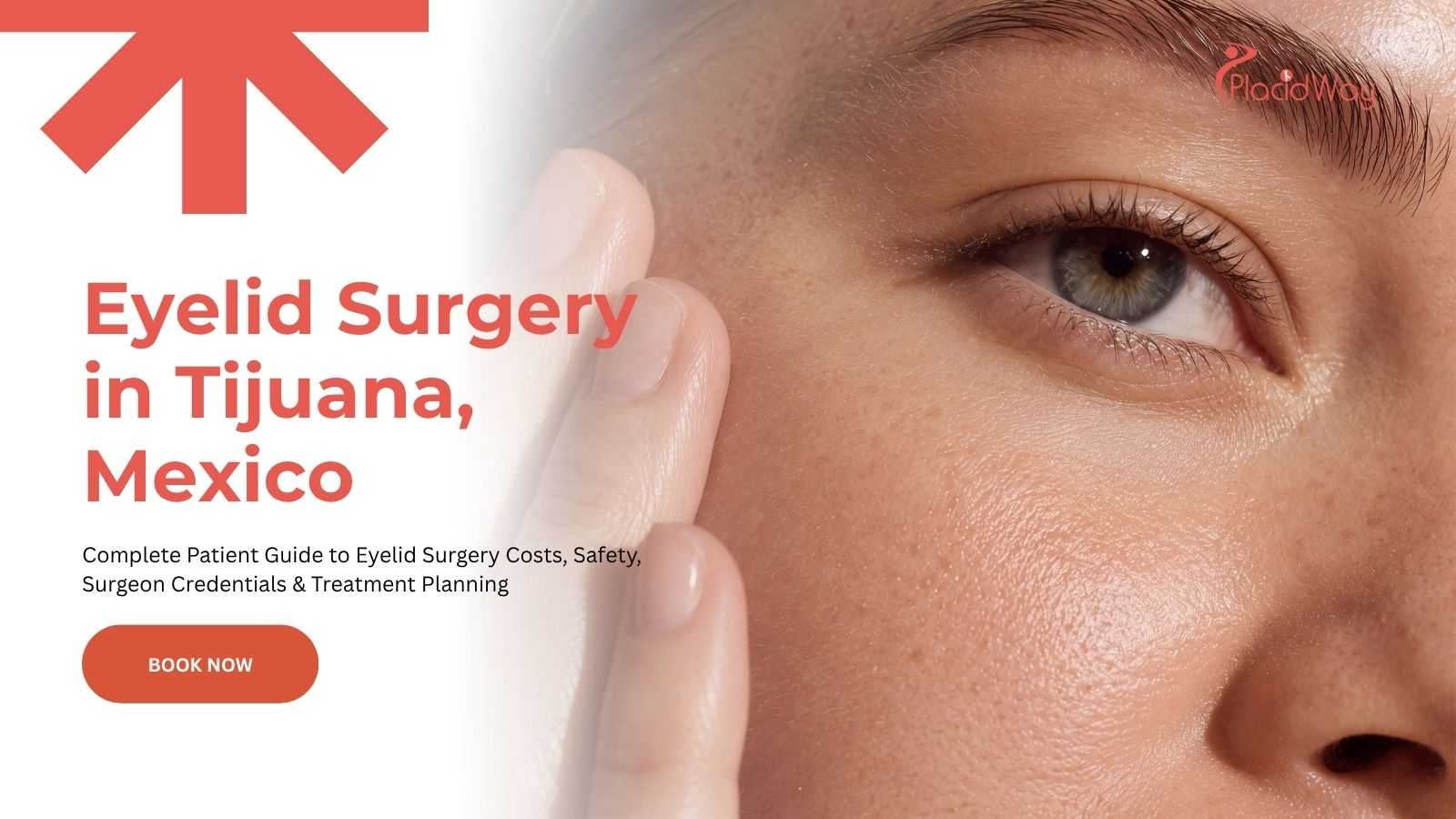 Eyelid surgery in Tijuana, Mexico