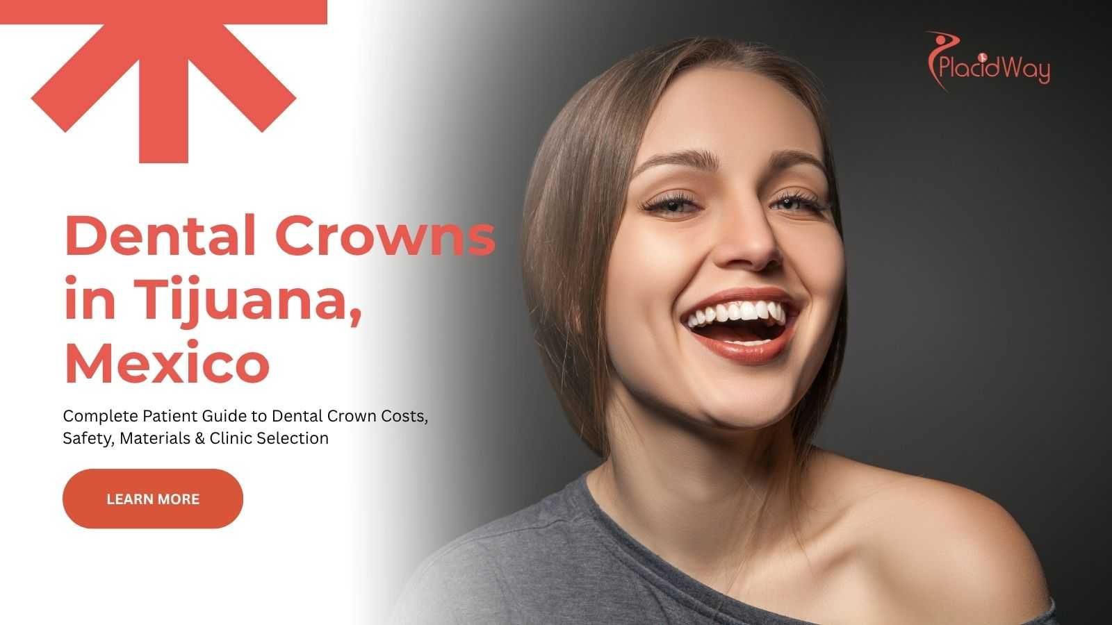Dental crowns in Tijuana, Mexico