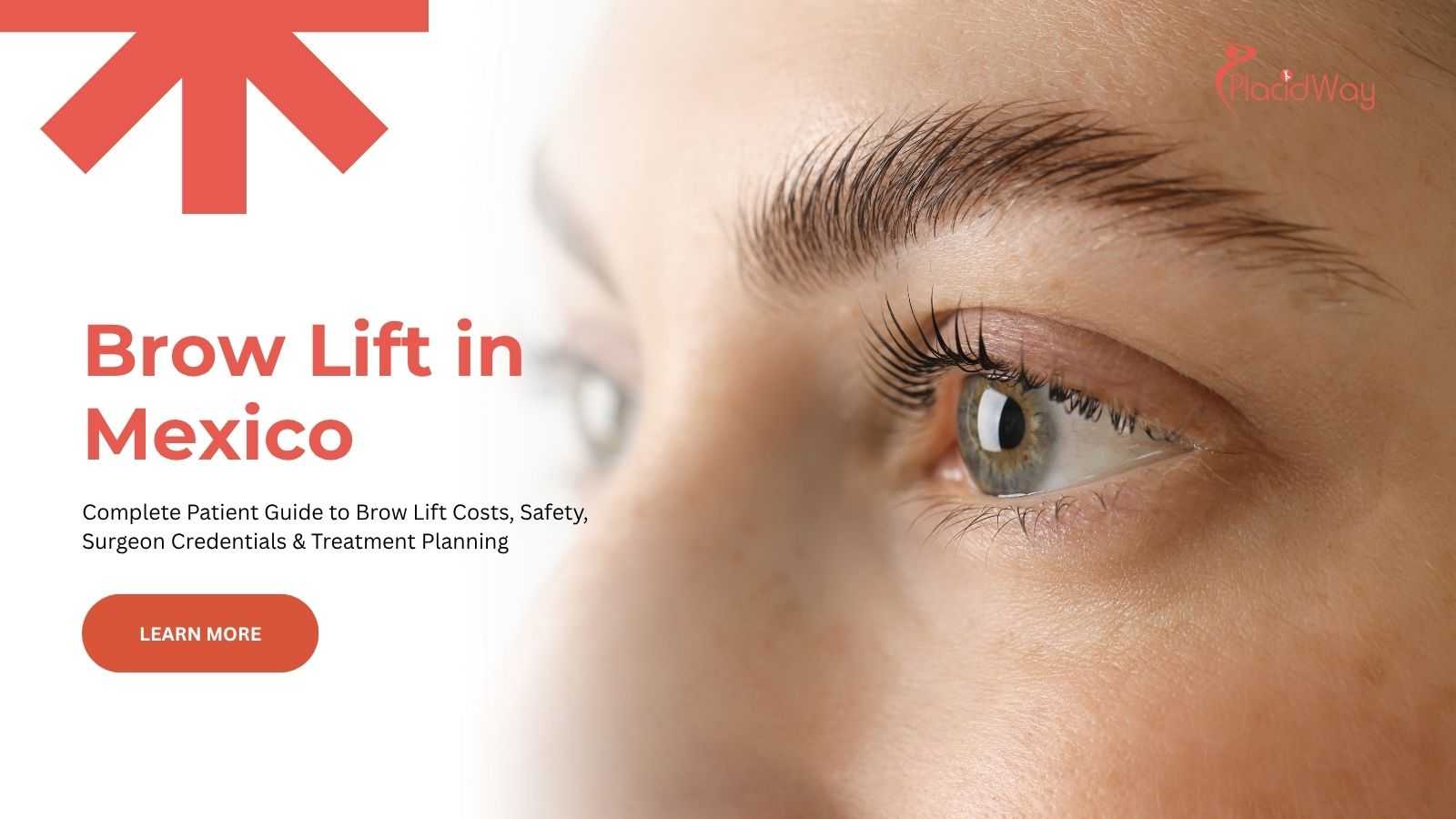 Brow lift surgery in Mexico