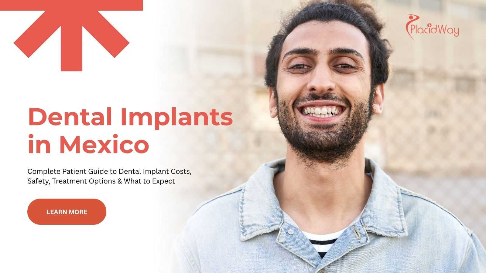Dental implants in Mexico