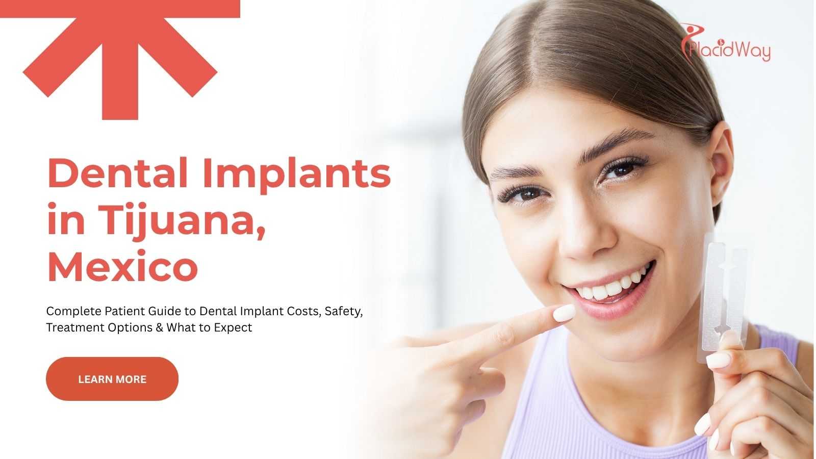 Dental implants in Tijuana, Mexico
