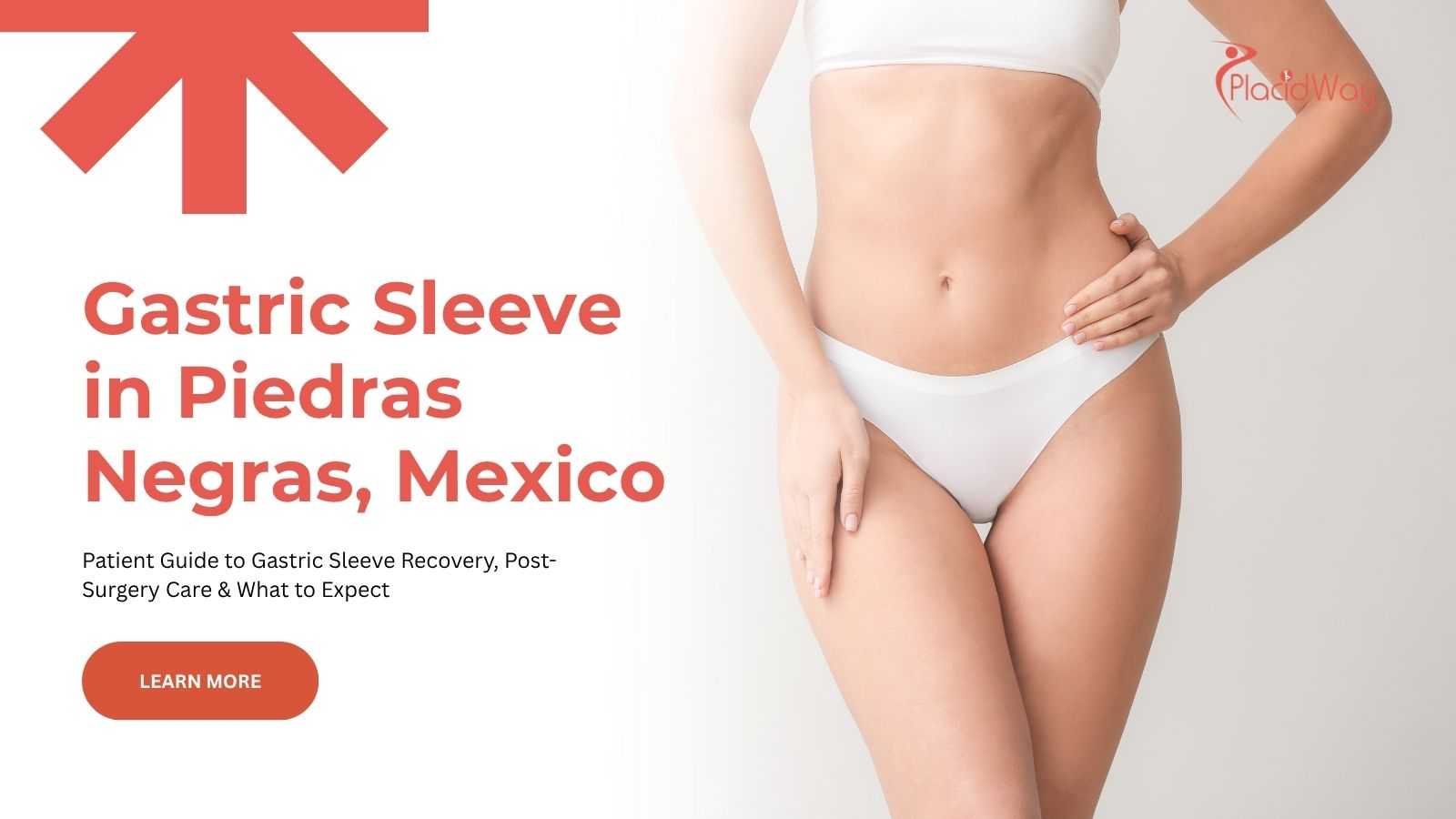 Gastric sleeve surgery in Piedras Negras, Mexico