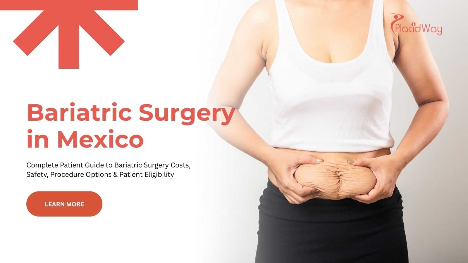 Bariatric surgery in Mexico