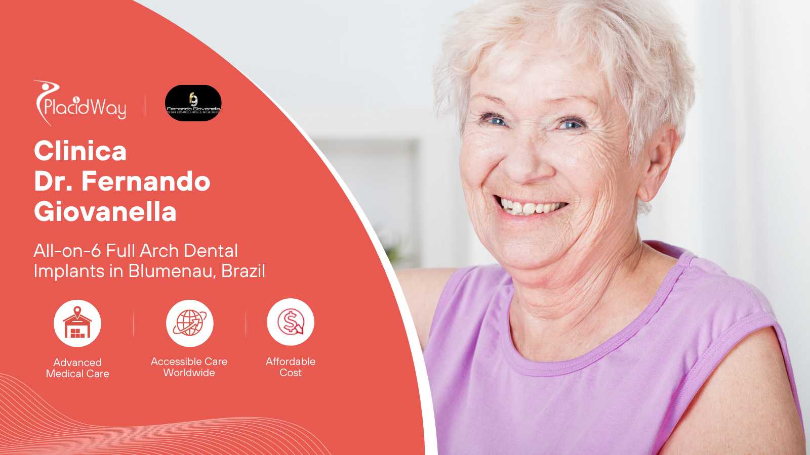 All-on-6 Fixed Full Arch Package in Blumenau, Brazil