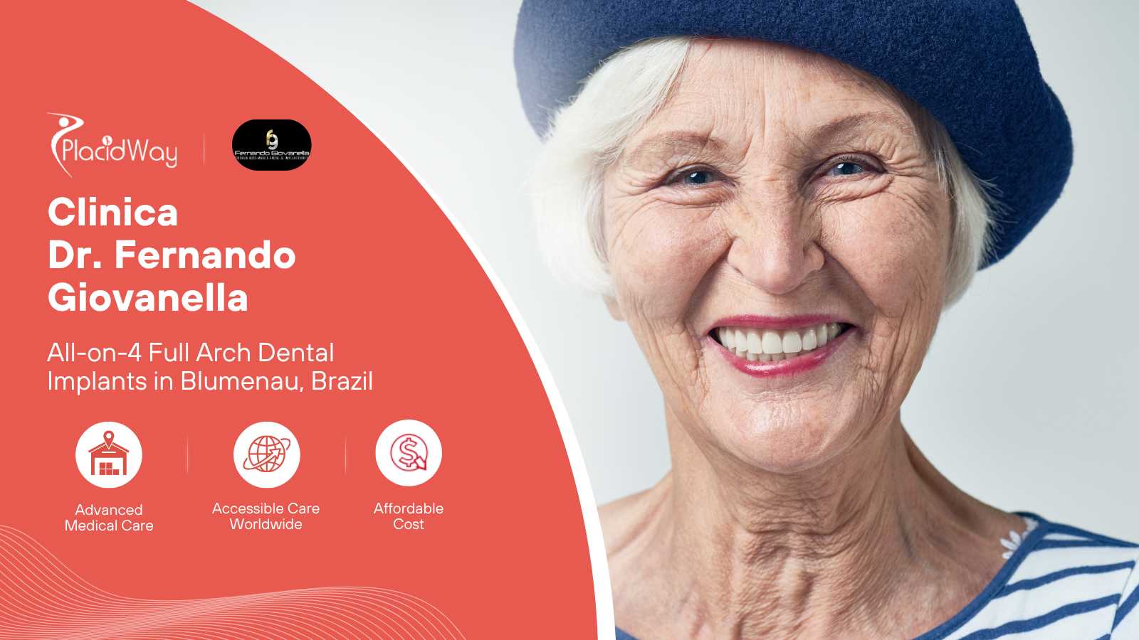 All-on-4 Fixed Full Arch Package in Blumenau, Brazil
