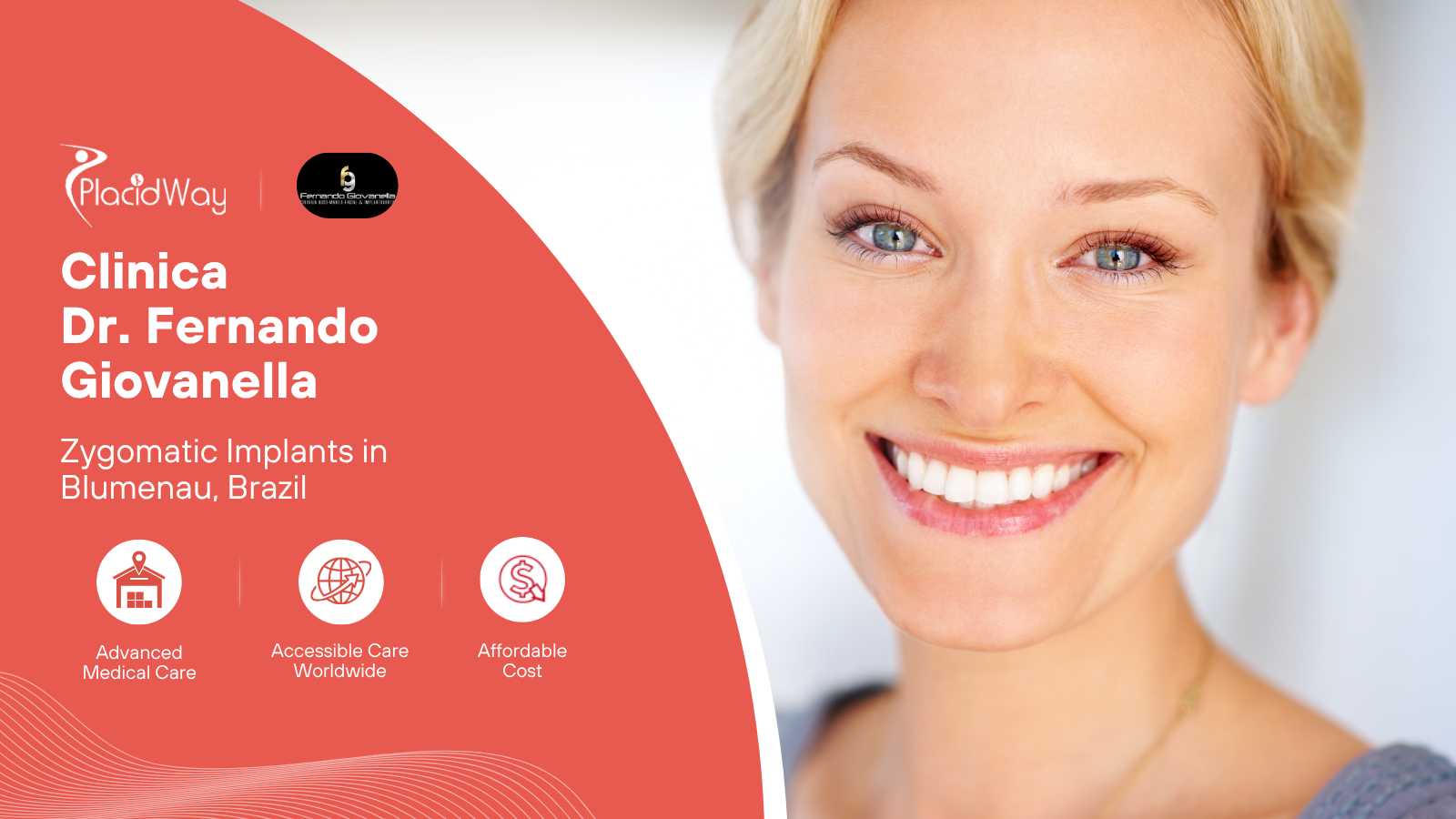 Zygomatic Implants Full Arch Package in Blumenau, Brazil