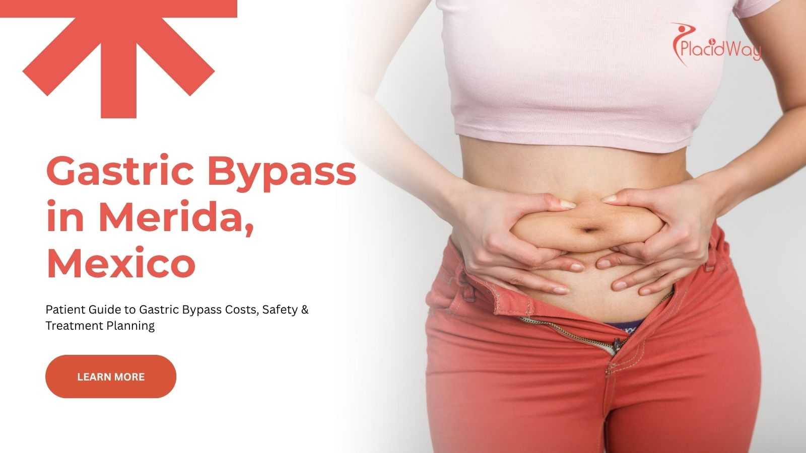 Gastric bypass surgery in Merida, Mexico
