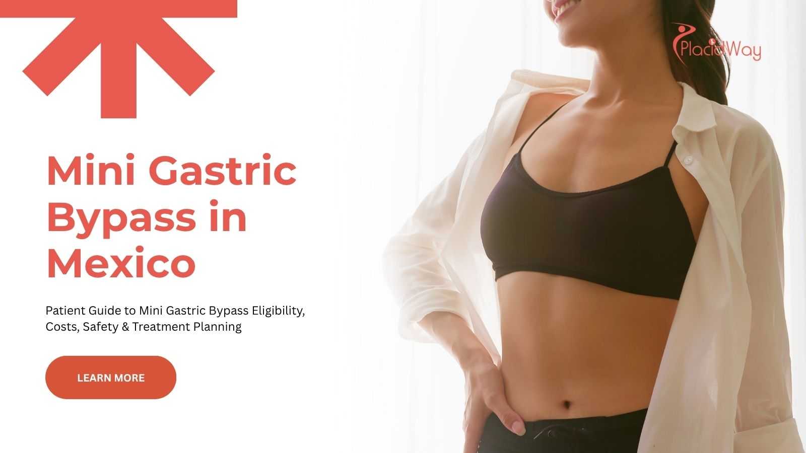 Mini gastric bypass in Mexico