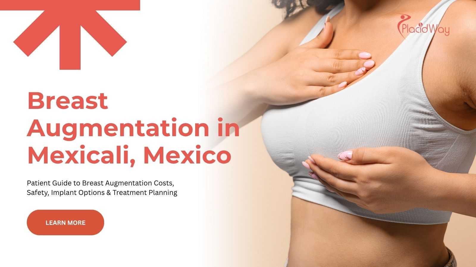 Breast augmentation in Mexicali, Mexico