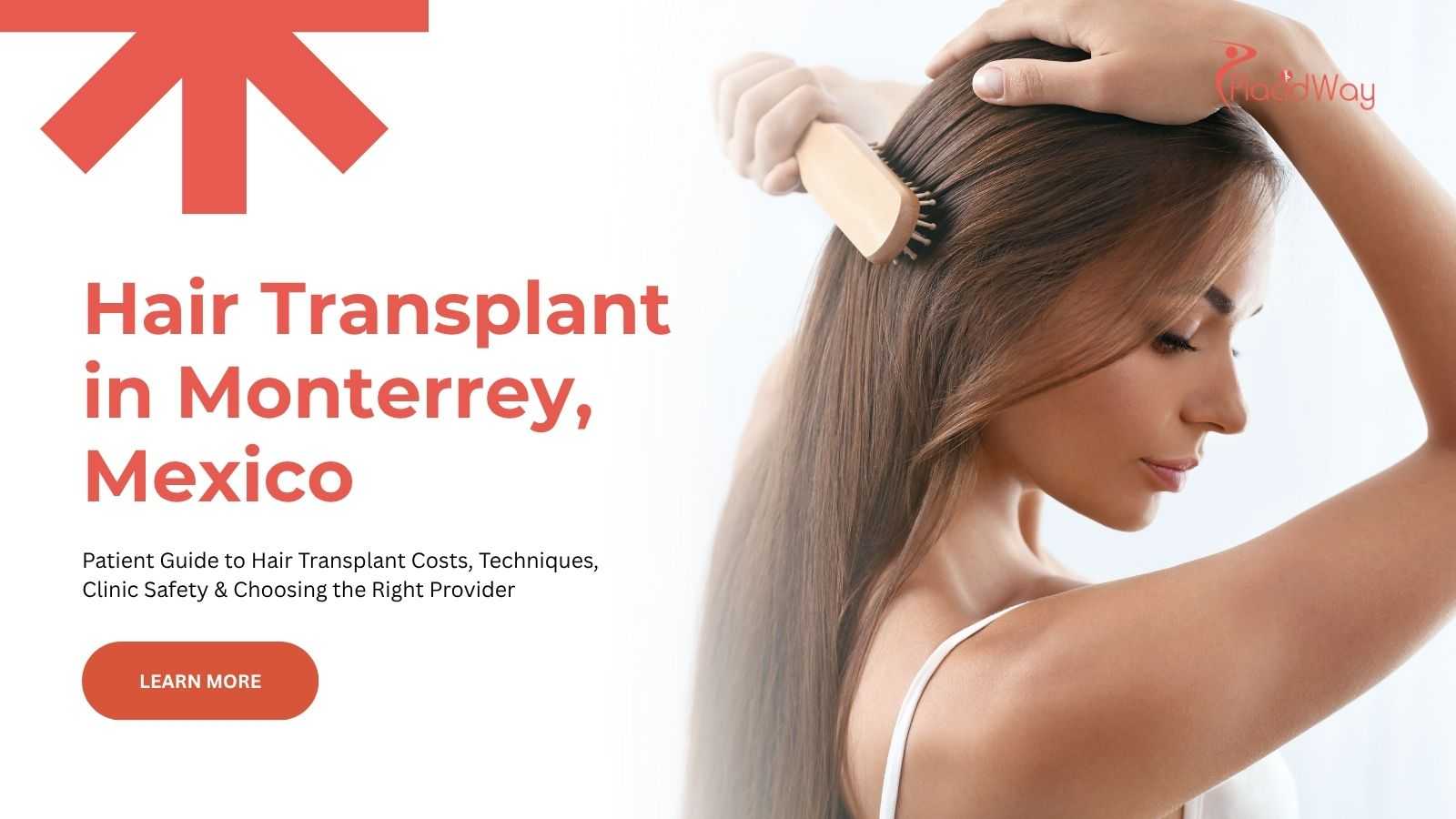Hair transplant in Monterrey, Mexico
