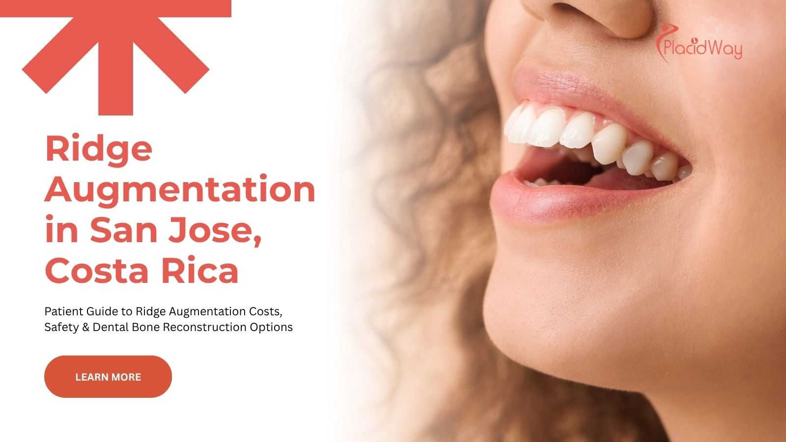 Dental ridge augmentation in San Jose, Costa Rica