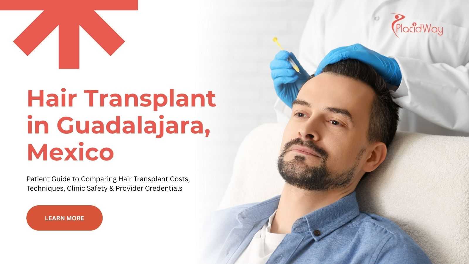 Hair transplant in Guadalajara, Mexico