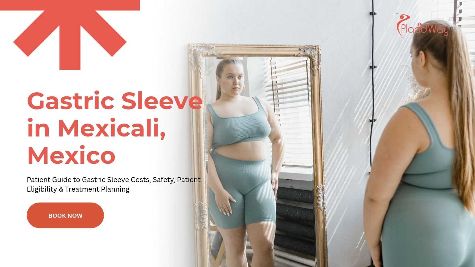 Gastric sleeve surgery in Mexicali, Mexico