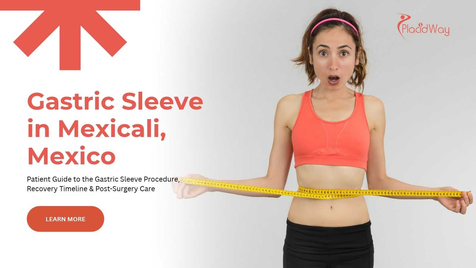 Gastric sleeve surgery in Mexicali, Mexico