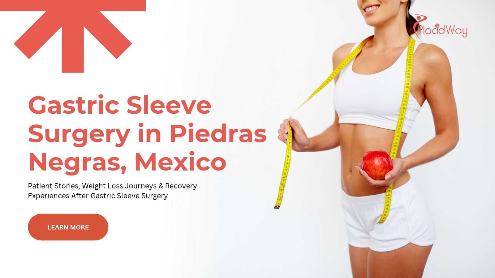 Gastric sleeve surgery in Piedras Negras, Mexico