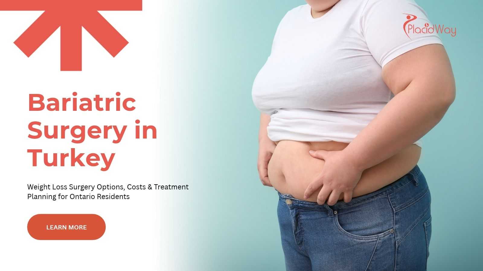 Bariatric surgery in Turkey for Ontario residents