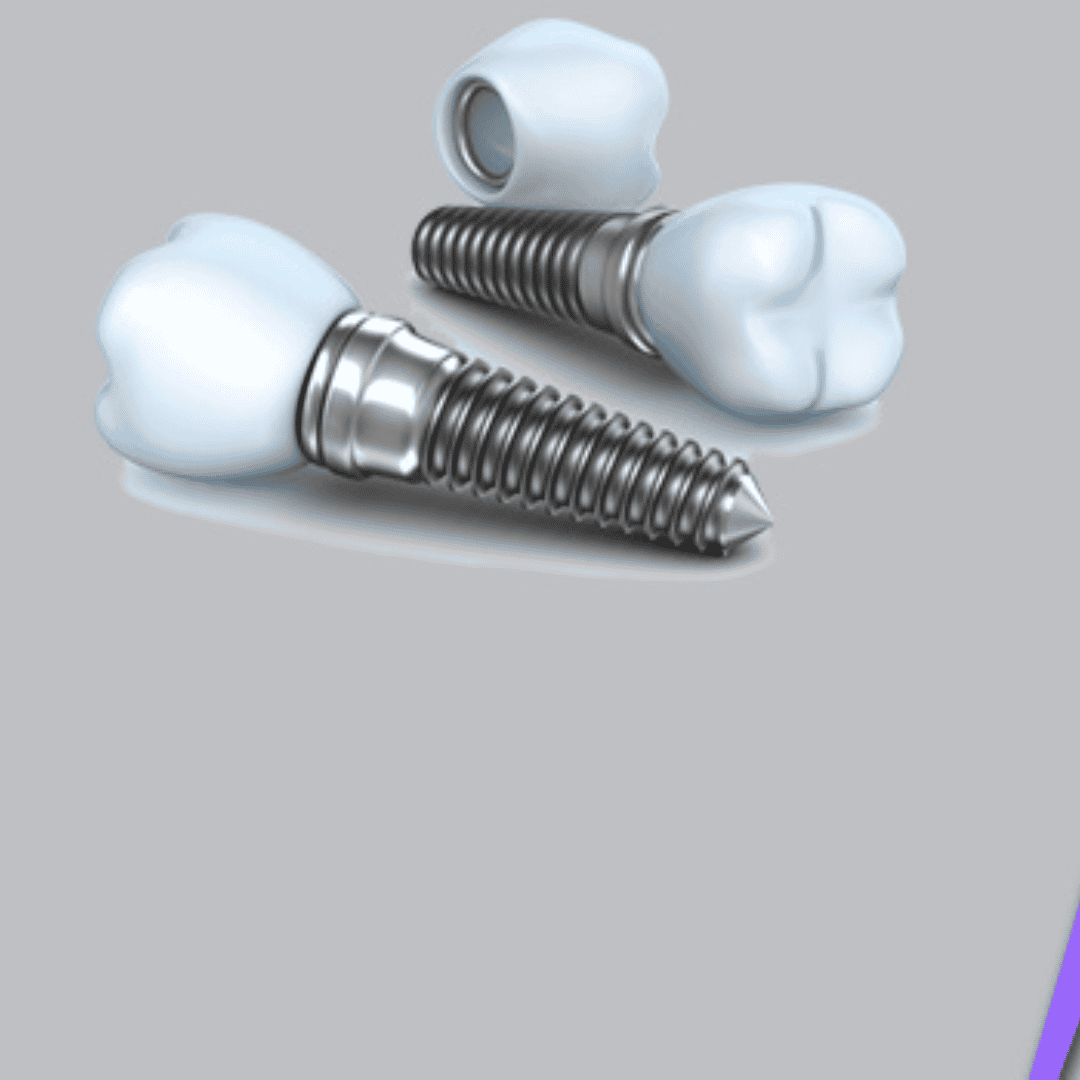 Dental Implants in Puerto Vallarta - Cost, Clinics, Dentists
