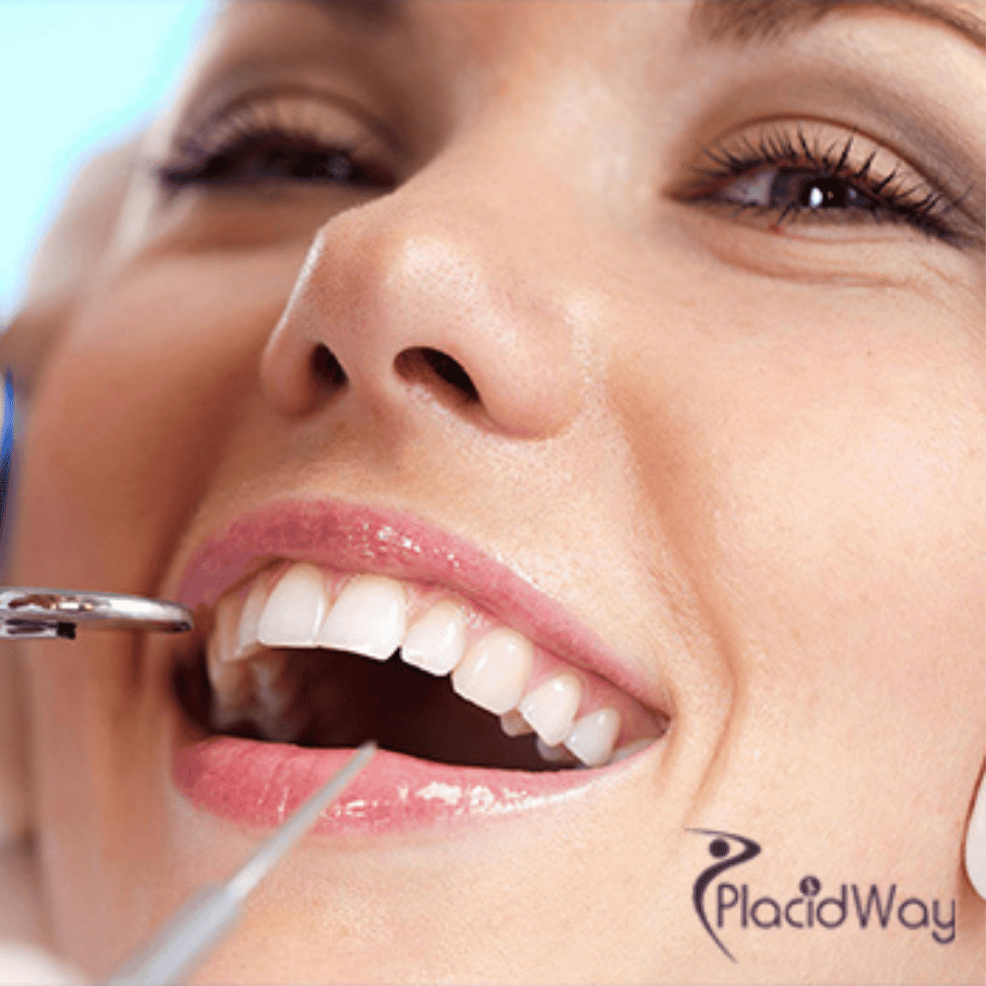 What's Driving the Smile Makeover Trend Among Middle Eastern Patients in Turkey?