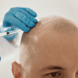Best Countries for Hair Transplant Surgery in 2026