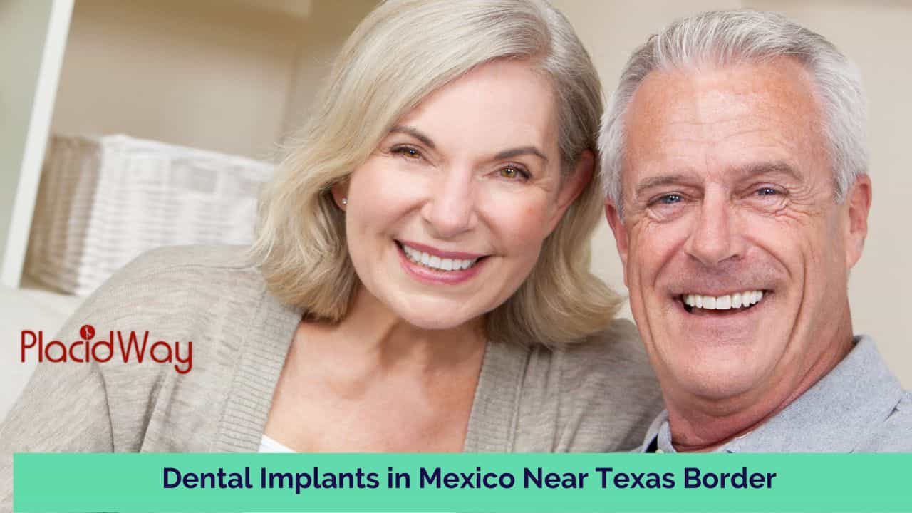 Dental Implants in Mexico Near Texas Border - Save 70 % in 2026