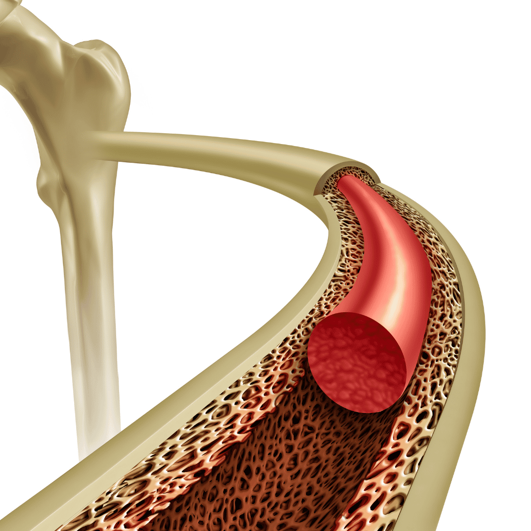 Bone Marrow Transplant Cost in Turkey 2026