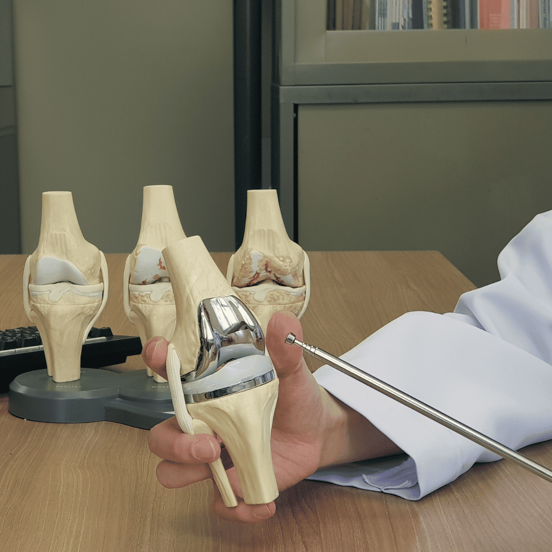 Knee Replacement in Istanbul vs. Germany: 2026 Cost and Quality Comparison