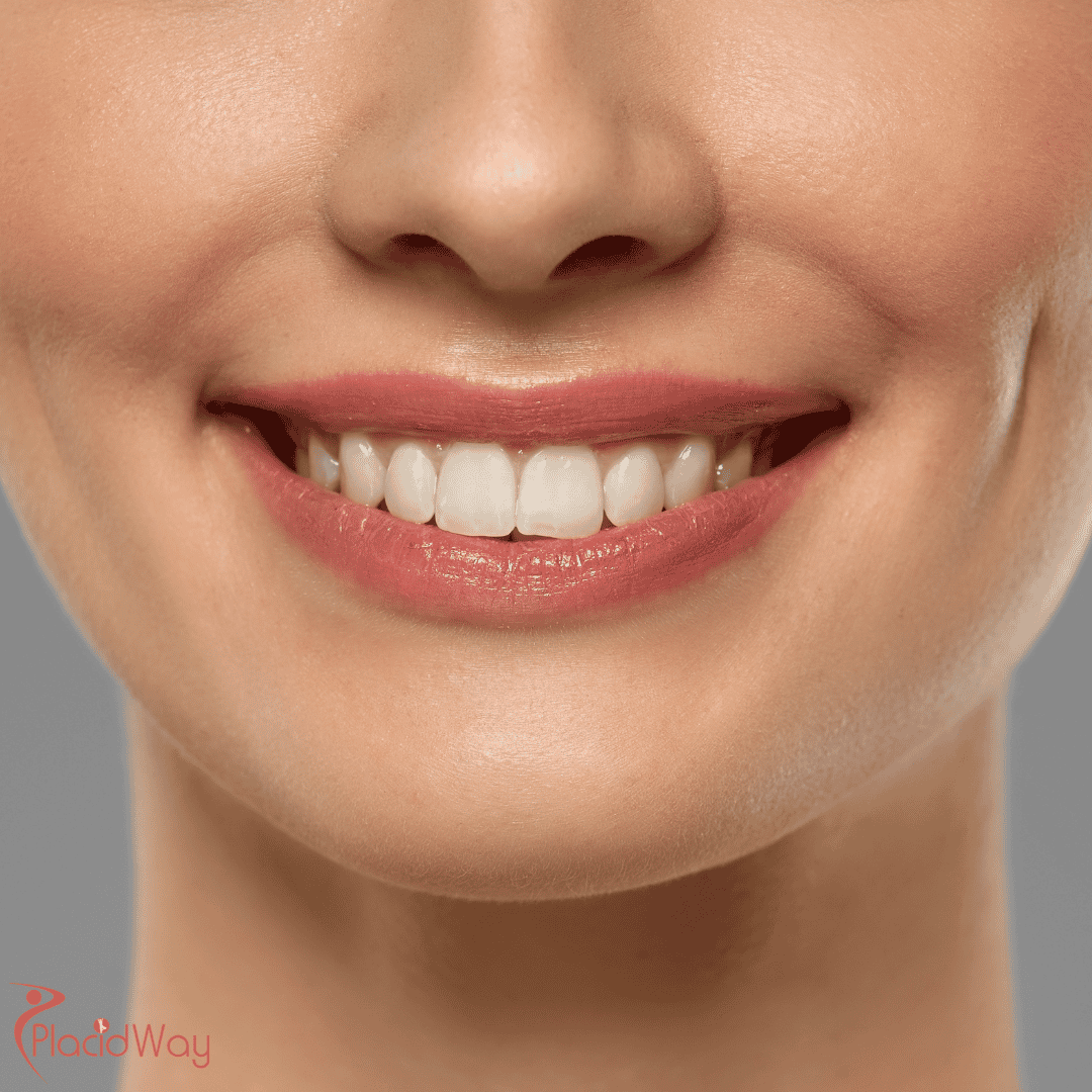 عملية تجميل الغمازات في جانجنام: أحدث جراحات التجميل في كوريا الجنوبية