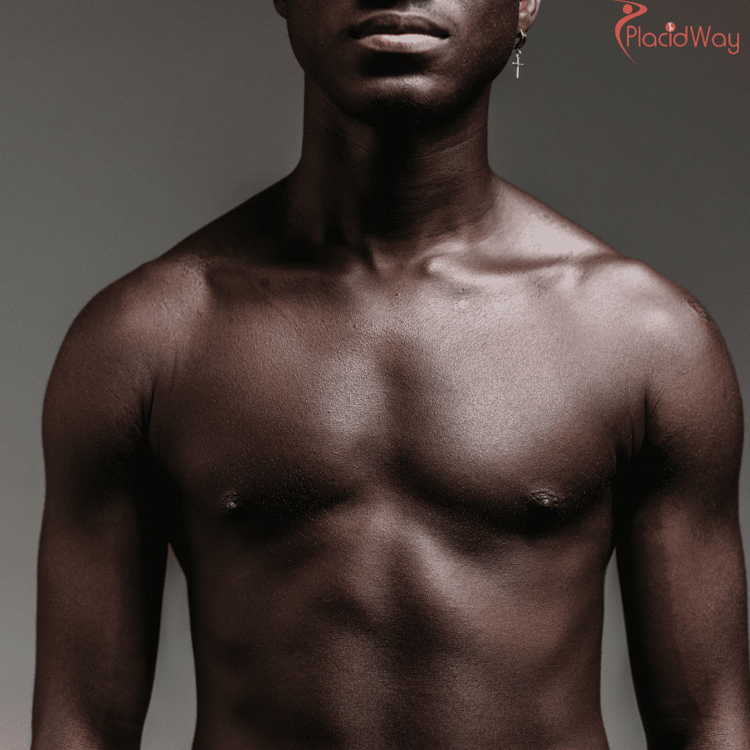 Learn about Pectoral Augmentation in New Delhi, India