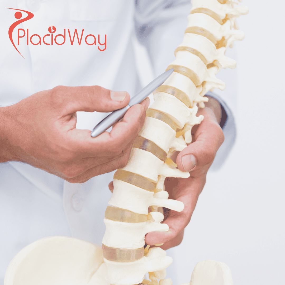 Spine Surgery in Mexico-Truth behind affordability & quality