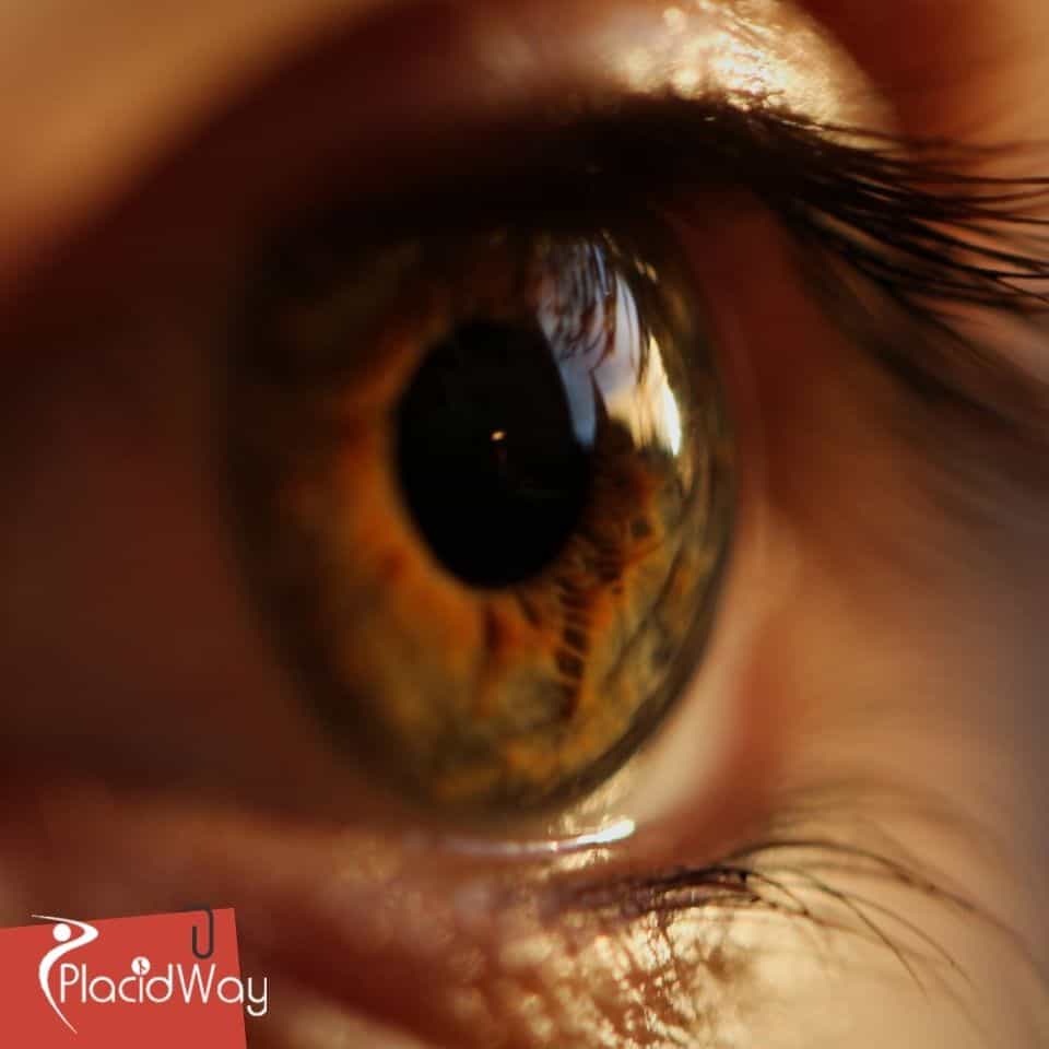 LASIK-Augenoperation in der Türkei: Das beliebte Verfahren zur Sehkorrektur bei deutschen Patienten