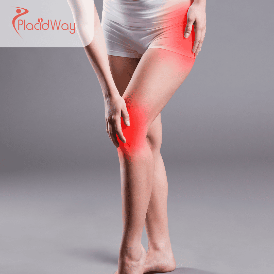 Joint Arthroscopy in Mexico: Minimally Invasive Treatments for Arizona Patients